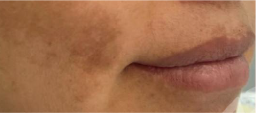 Antes 13