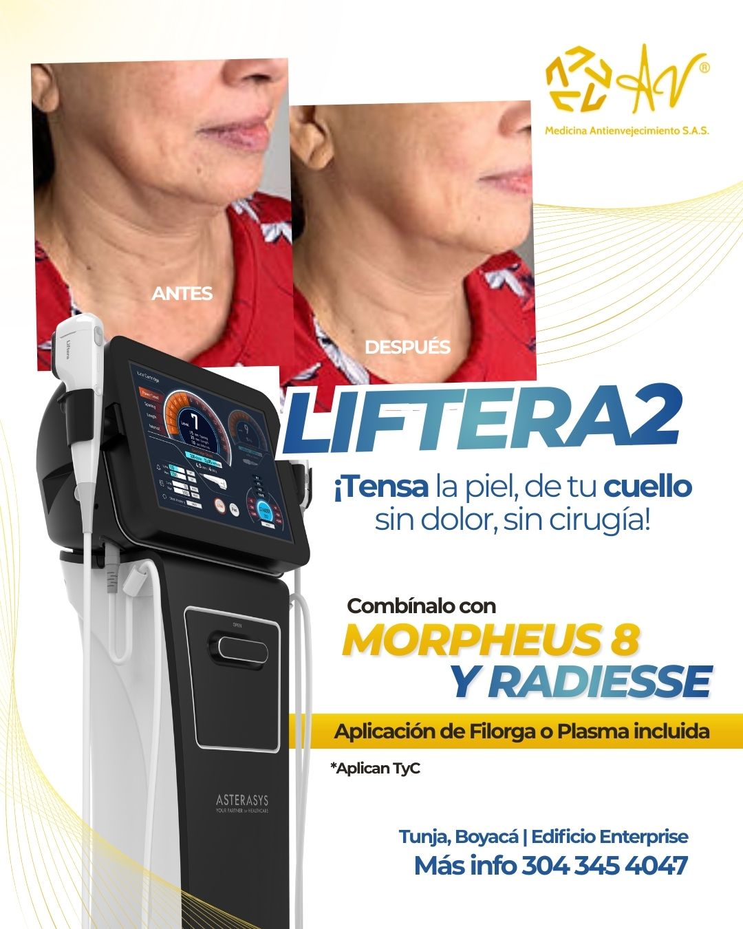 20251124-promoliftera4