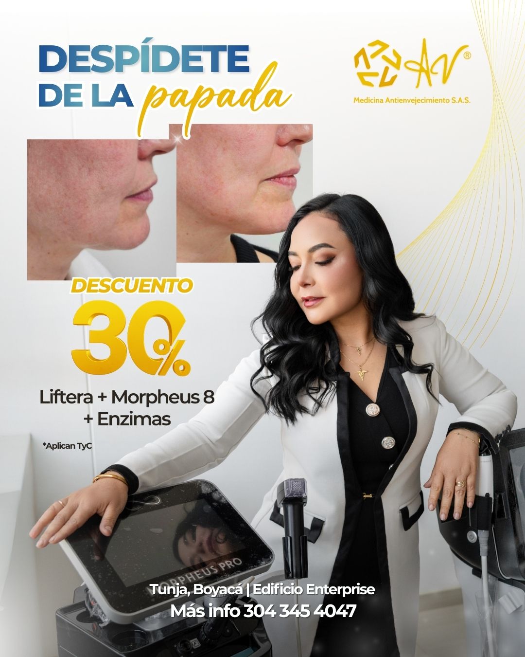 20251124-promoliftera5